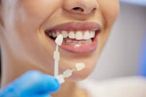 Shot of an unrecognisable woman having her teeth capped at the dentist.