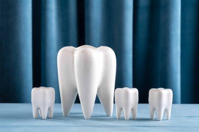 models of human teeth on the background of blue velvet curtains