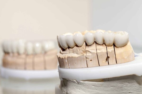 Zirconium Porcelain Tooth plate in Dentist Store
